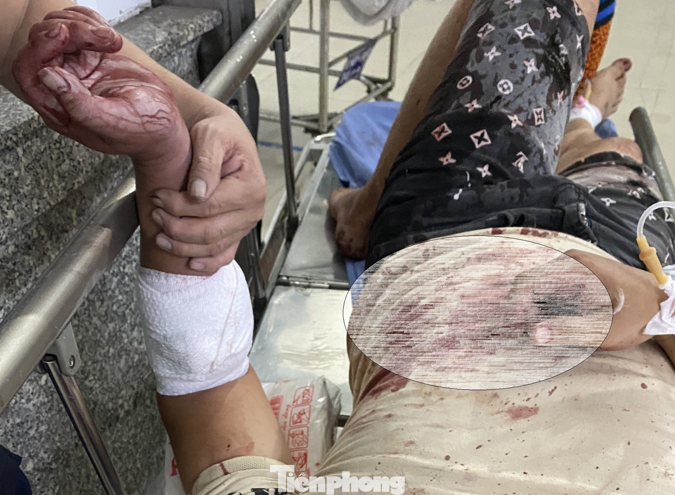 Nạn nhân bị chém gây nhiều thương tích