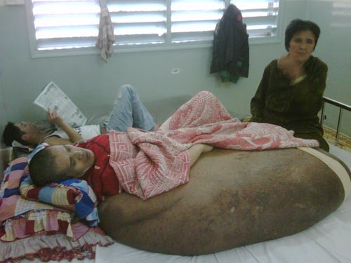 Các chuyên gia y tế sẽ mổ khối u cho bệnh nhân vào ngày 5-1. Các chuyên gia y tế sẽ mổ khối u cho bệnh nhân vào ngày 5-1