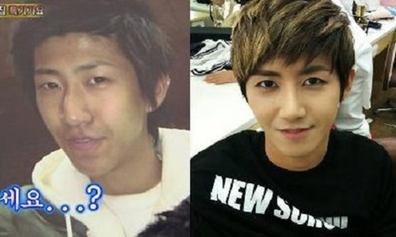 Kyuhyun (Super Junior), Chaeyeon (DIA), Kwanghee (ZE:A) là ba trong những thần tượng hiếm hoi công khai bản thân đã phẫu thuật thẩm mỹ.