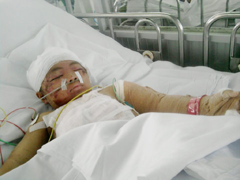 Cháu Vinh trong những ngày ở bệnh viện. Ảnh: Bee.ne