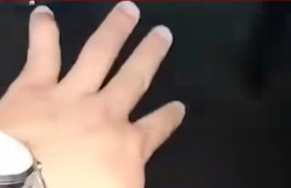 Ngón tay út anh Tiến bị thương. Ảnh cắt từ clip