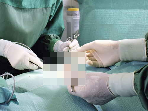 Theo các bác sĩ chuyên khoa Nam học, bơm silicon làm to dương vật sớm muộn cũng gặp biến chứng