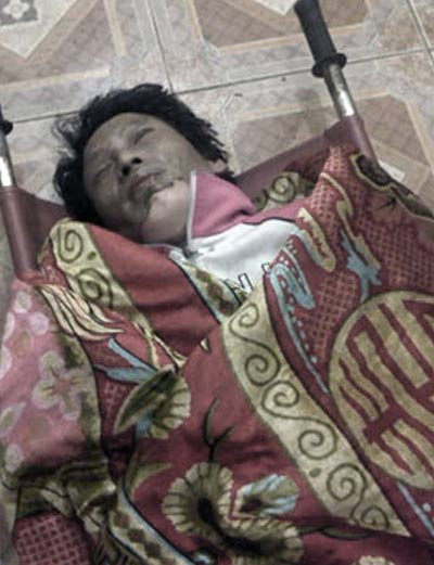 Người cha mất nhân tính bị bỏng khi thiêu chết hai con.. Người cha mất nhân tính bị bỏng khi thiêu chết hai con.