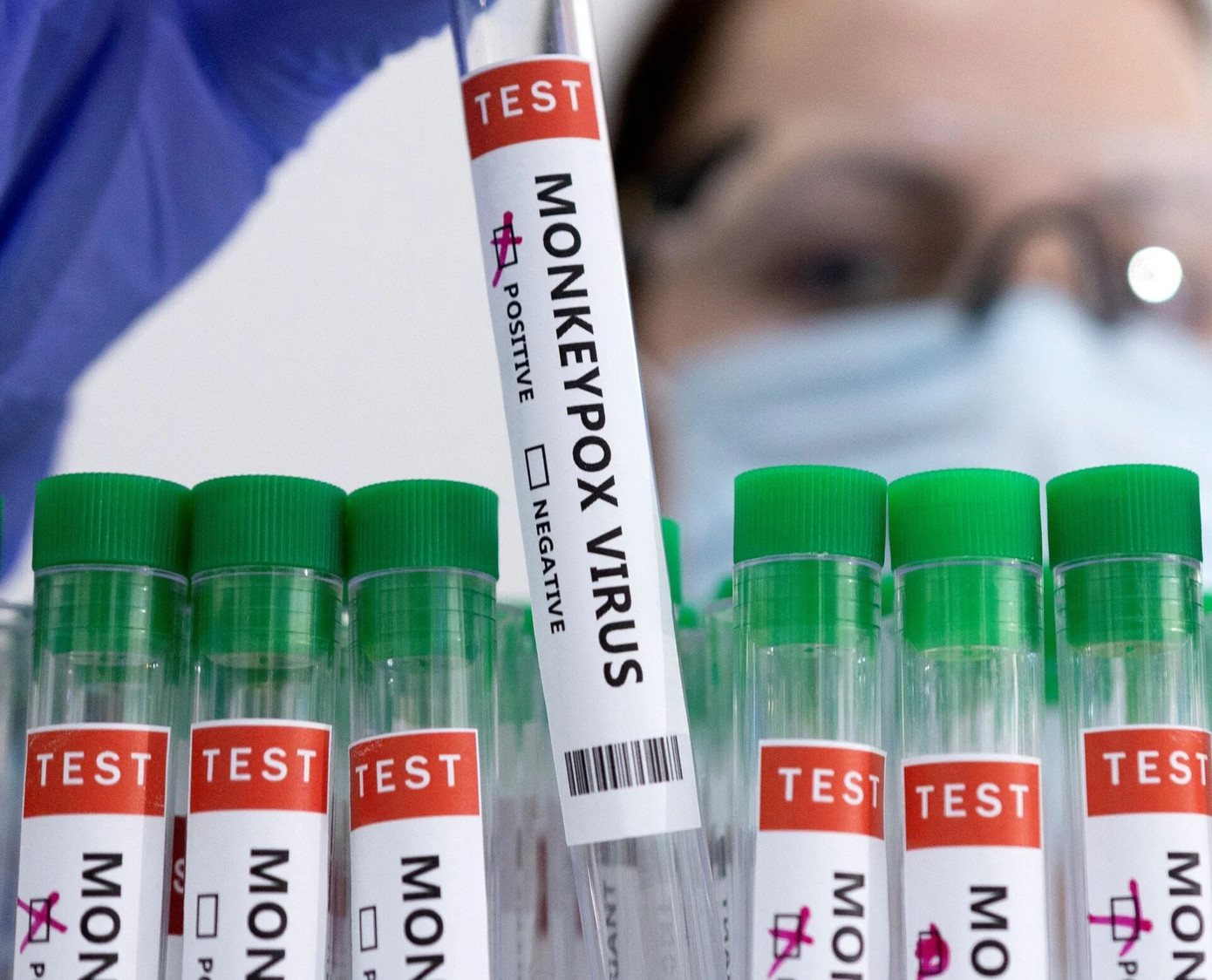 Trong 7 tháng đầu năm nay, TP HCM đã ghi nhận 49 người mắc bệnh đậu mùa khỉ. Trong 7 tháng đầu năm nay, TP HCM đã ghi nhận 49 người mắc bệnh đậu mùa khỉ.