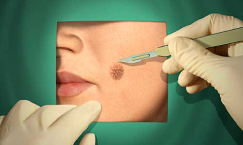 Ảnh minh họa - Internet