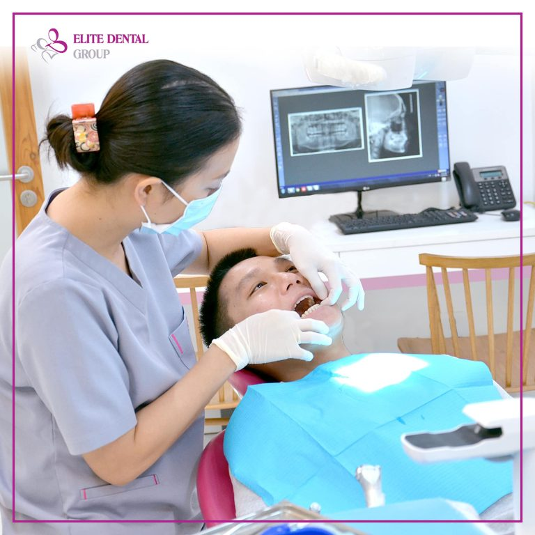 Bạn nên đến gặp bác sĩ để kiểm tra và xác định có thể nhổ nhiều răng khôn cùng lúc hay không.