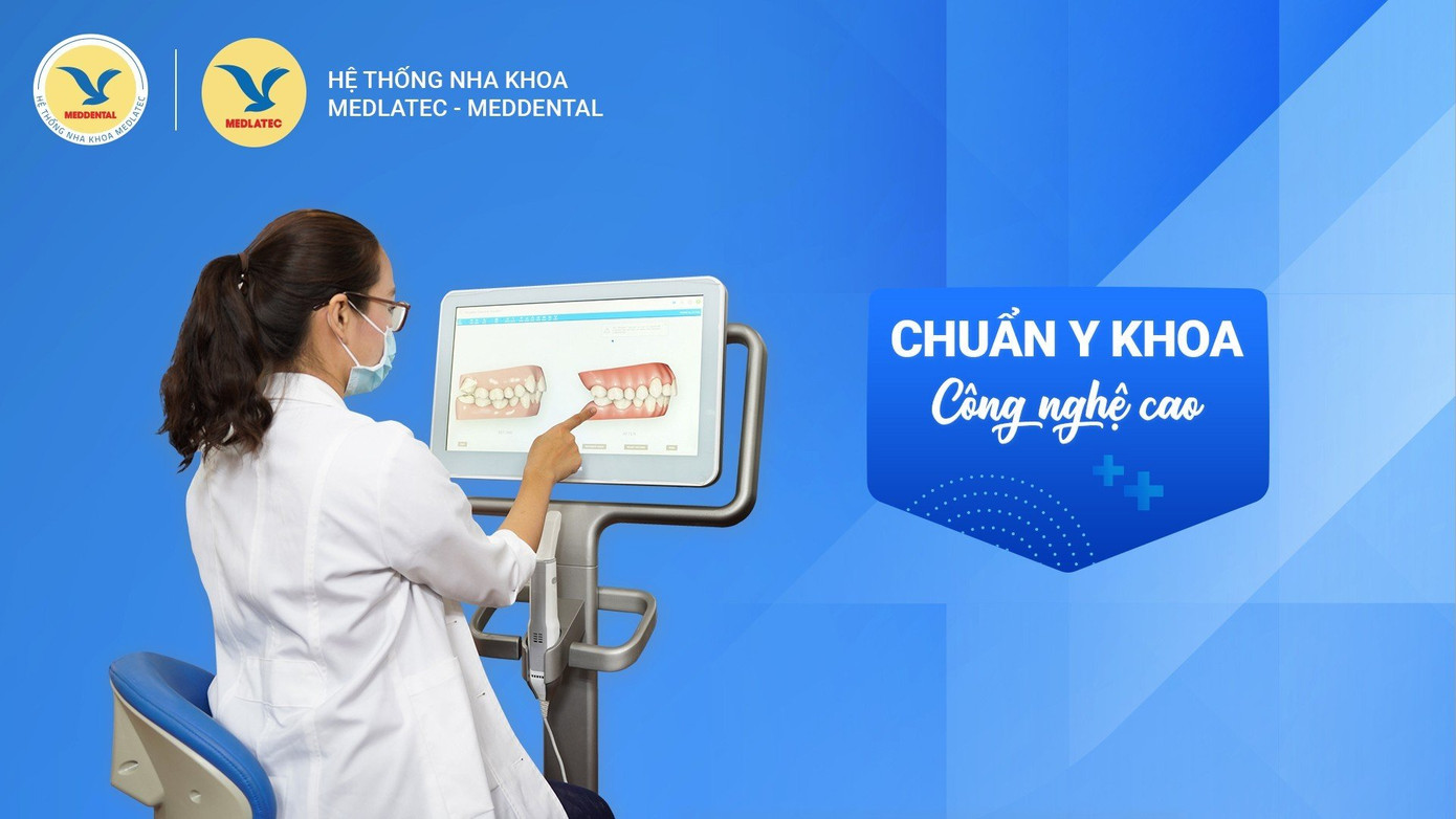 Hình ảnh Thạc Sĩ – Bác Sĩ Cao Thị Ngọc ứng dụng công nghệ iTero điều trị chỉnh nha