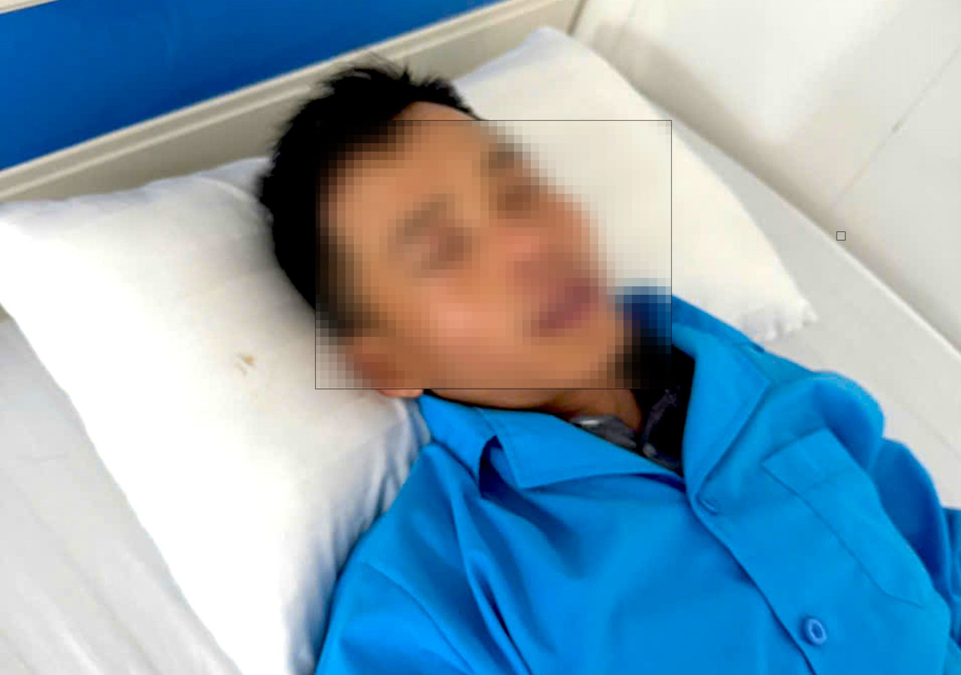 Vết thương ở mắt của bệnh nhân Hội đã ổn định, qua giai đoạn xấu nhất, đang được tiếp tục theo dõi