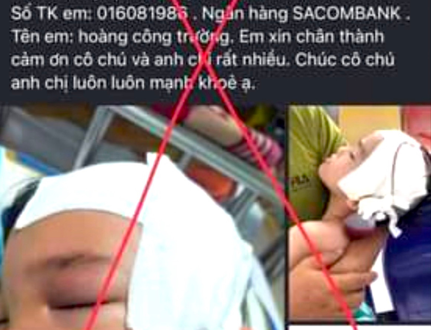 Đối tượng đăng hình ảnh em bé bị đau lên các trang mạng xã hội để lừa đảo