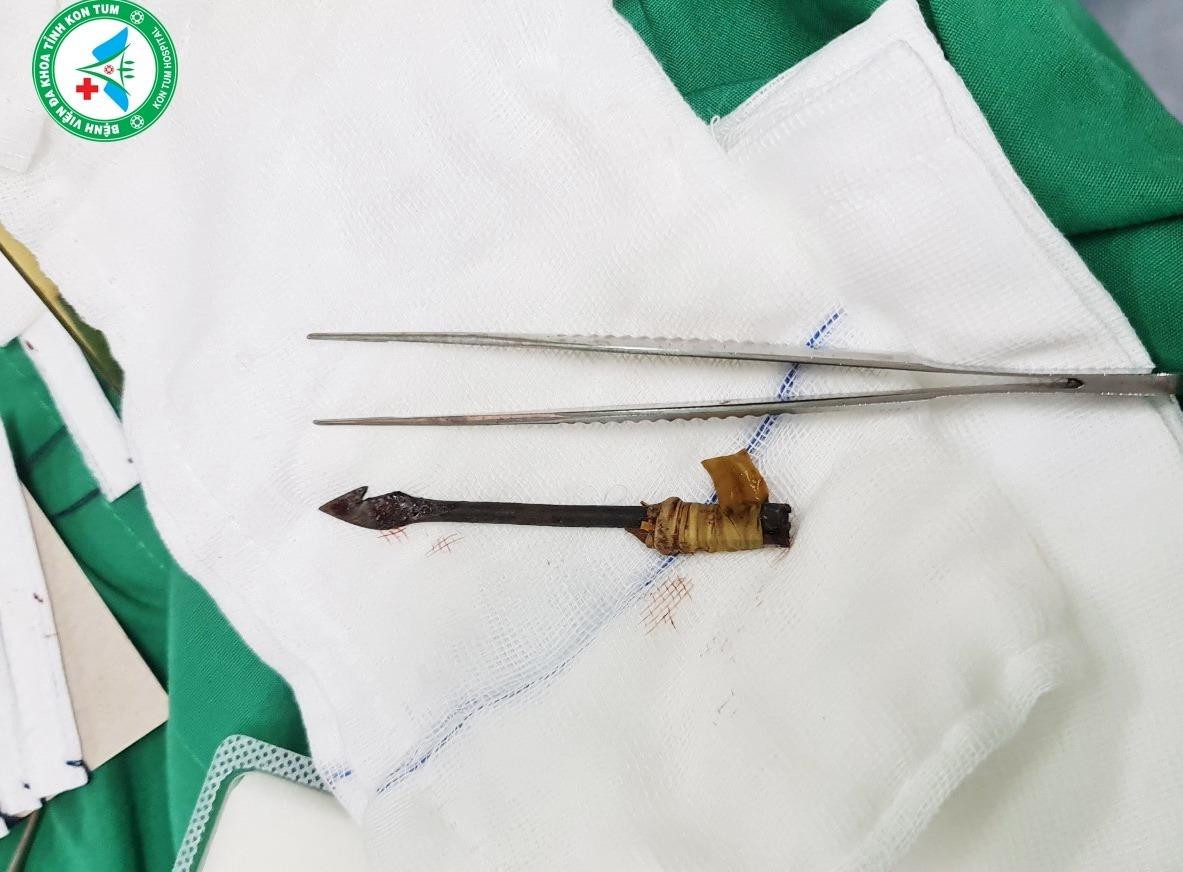 Mũi tên tự chế trong mắt em A.T.