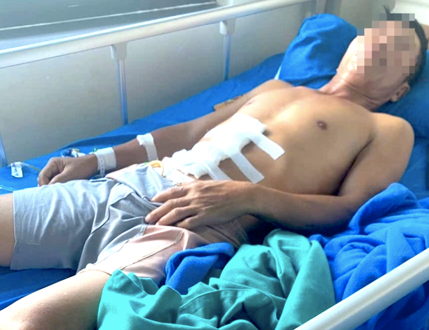 Bệnh nhân H thời điểm phải mổ cấp cứu do bị vỡ ruột thừa