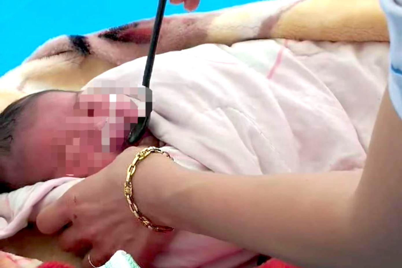 Các y bác sĩ cho bé trai uống sữa