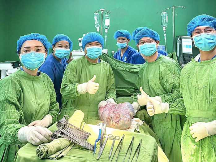 Khối u khổng lồ được các y bác sĩ Bệnh viện Đại học Y Dược-Hoàng Anh Gia Lai phẫu thuật lấy ra thành công