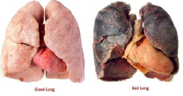 10 dấu hiệu cảnh báo ung thư sớm không thể làm ngơ ảnh 1