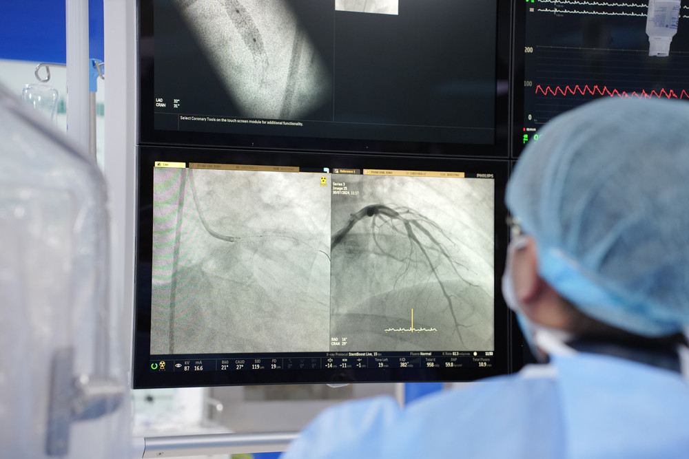 Đối tượng nguy cơ chảy máu cao có khả năng gặp nhiều rủi ro trong quá trình can thiệp mạch vành Đối tượng nguy cơ chảy máu cao có khả năng gặp nhiều rủi ro trong quá trình can thiệp mạch vành