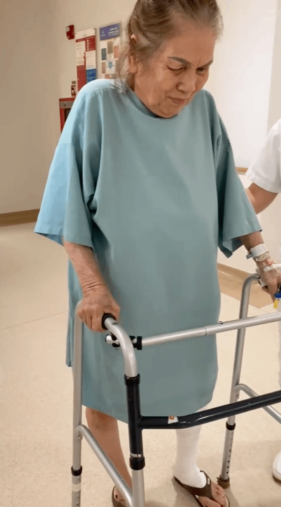 Bác Liên đã có thể đi lại ngay sau mổ 10 tiếng và ra viện chỉ sau 5 ngày Bác Liên đã có thể đi lại ngay sau mổ 10 tiếng và ra viện chỉ sau 5 ngày