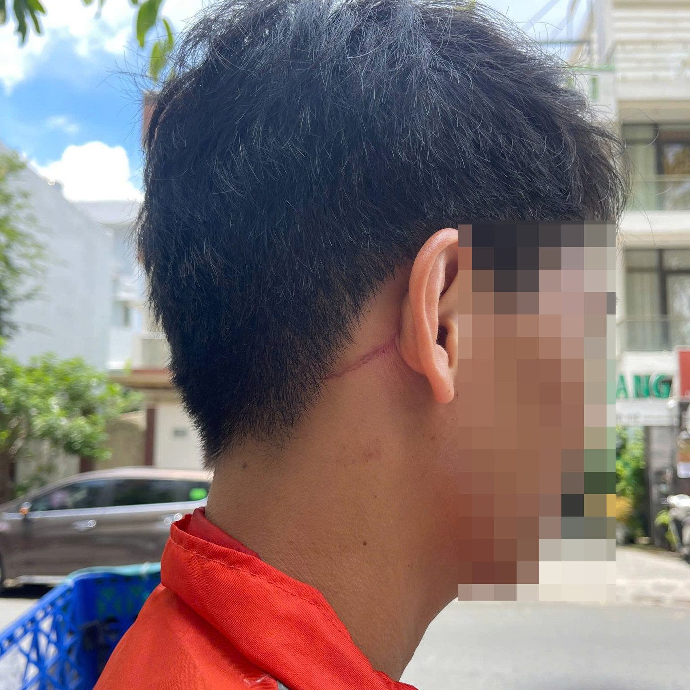 Vết thương trên vùng đầu anh P. do bị đánh. Ảnh: C.A. Vết thương trên vùng đầu anh P. do bị đánh. Ảnh: C.A.