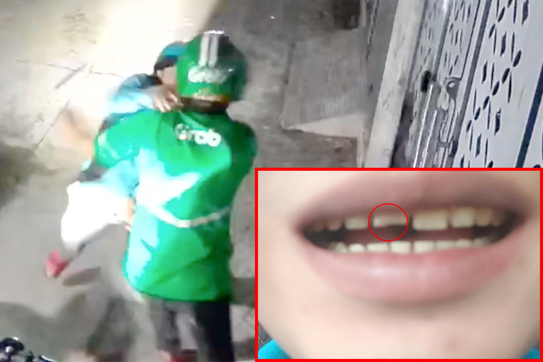 Anh L. (người mặc áo khoác màu xanh lá cây) bị tài xế xe ôm công nghệ đánh mẻ răng cửa (ảnh nhỏ). Ảnh: H.T. Anh L. (người mặc áo khoác màu xanh lá cây) bị tài xế xe ôm công nghệ đánh mẻ răng cửa (ảnh nhỏ). Ảnh: H.T.