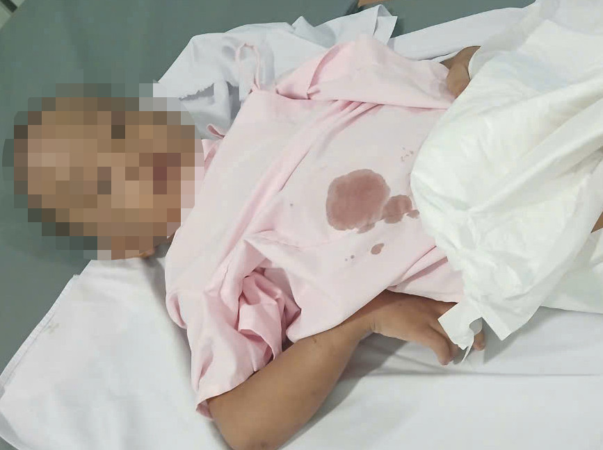 Bé K. được đưa vào bệnh viện để sơ cấp cứu. Ảnh: A.X.