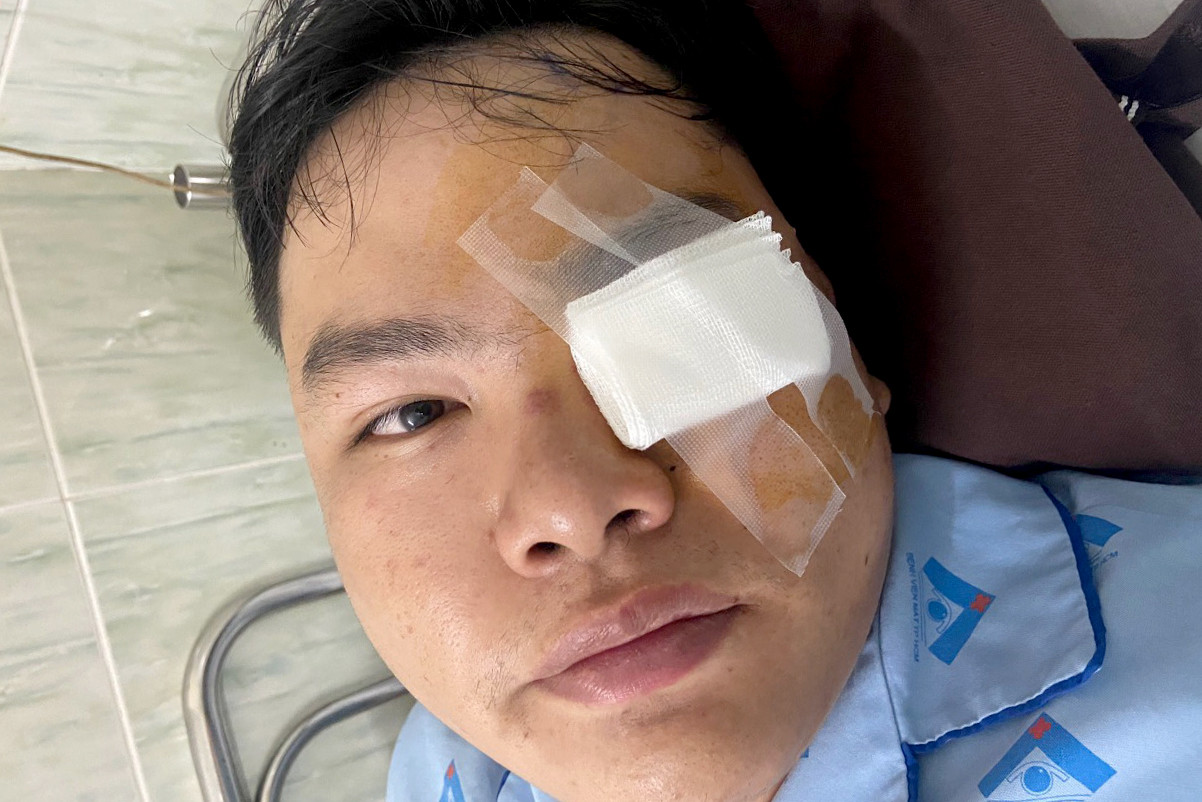 Mắt trái của anh N chỉ còn thị lực khoảng 30%. Ảnh: Nhân vật cung cấp. Mắt trái của anh N chỉ còn thị lực khoảng 30%. Ảnh: Nhân vật cung cấp.