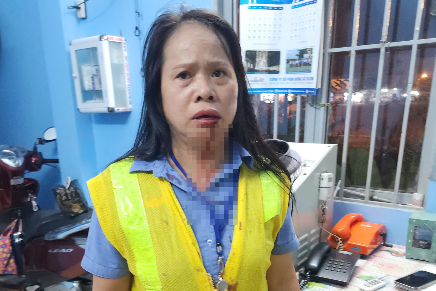 Bà Bình bị hành hung khi đang làm nhiệm vụ. Ảnh: A.X.