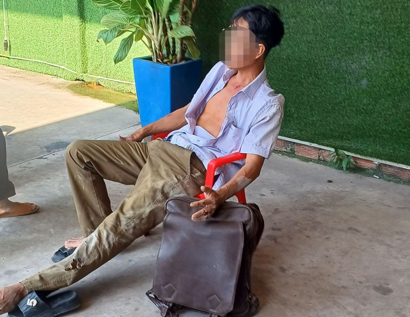 Người đàn ông lái xe máy bị thương nhẹ sau tai nạn.