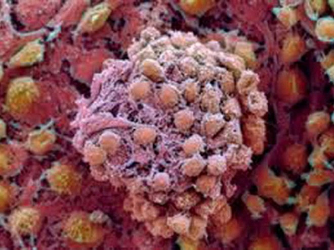 Nhân bản thành công tế bào gốc của người