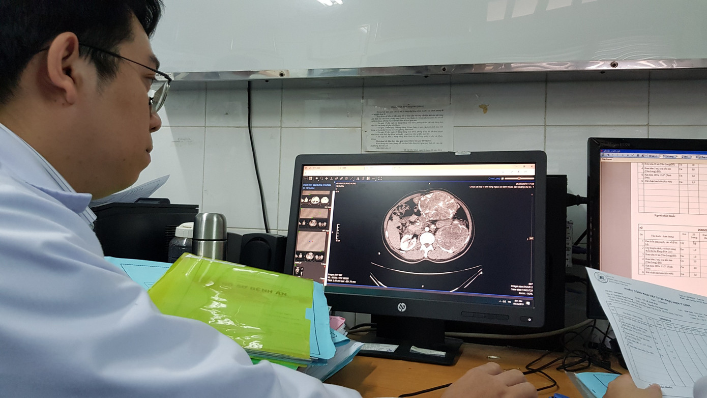 Đi khám vì bụng chướng, bệnh nhân tá hỏa khi bác sĩ ‘lôi ra’ 3 khối u ảnh 1