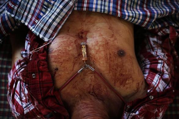 Tấm bùa hộ mệnh nằm cạnh vết đạn trên ngực người đàn ông thiệt mạng trong cuộc biểu tình ở Bangkok