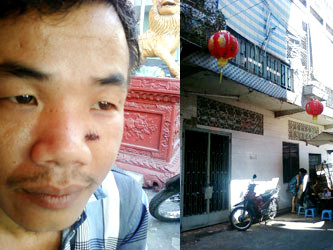 Anh Long với vết đạn bắn xuyên vào vùng dưới mắt (ảnh trái). Hiện trường nơi Tuấn và đồng bọn cướp sòng bạc vào sáng 13-2 (mùng 4 tết)