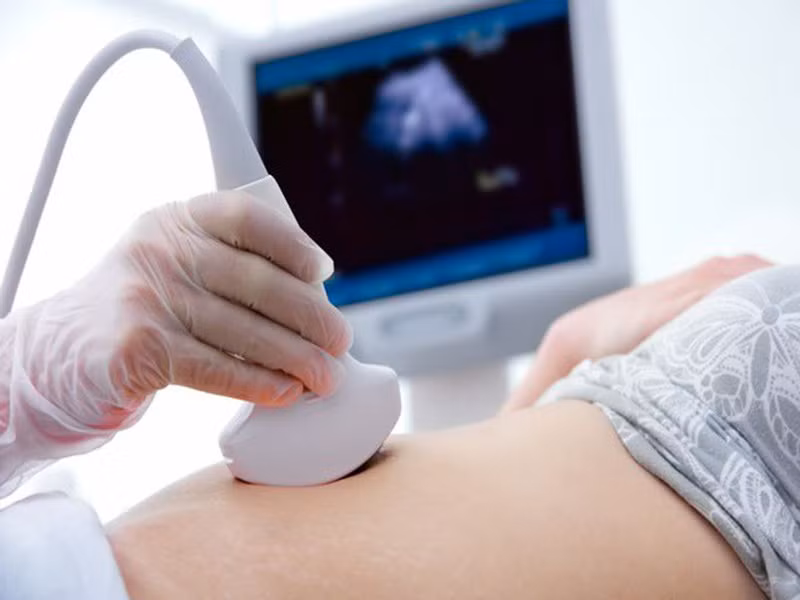 Người phụ nữ 'hết hồn' khi biết vòng tránh thai bị lạc vào ổ bụng ảnh 1