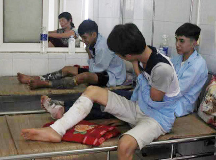 75 người bị bỏng phải nhập viện trong đêm lửa trại ảnh 2