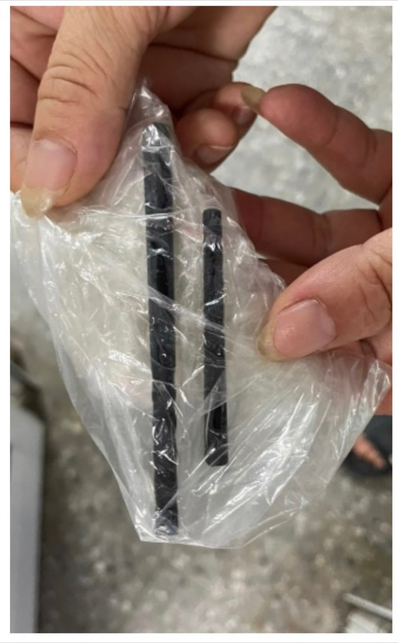 Đôi đũa được các bác sĩ lấy ra từ hộp sọ bệnh nhân Đôi đũa được các bác sĩ lấy ra từ hộp sọ bệnh nhân