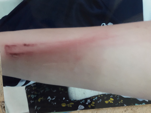 Cô bé 12 tuổi bị cha đánh phải nhập viện vì... 'ham chơi' ảnh 1