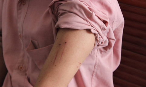 Táo tợn dùng roi điện, bình xịt hơi cay cướp 2,5 tỷ đồng ở Phú Yên ảnh 7