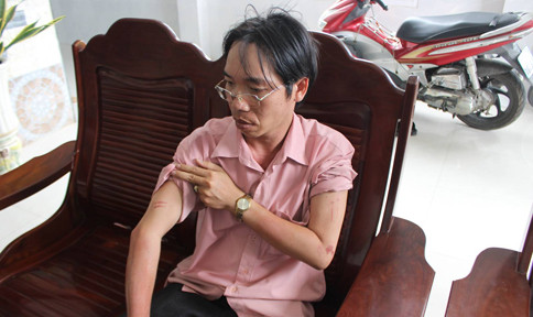 Táo tợn dùng roi điện, bình xịt hơi cay cướp 2,5 tỷ đồng ở Phú Yên ảnh 6