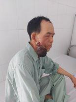 Bệnh nhân khi mới nhập viện chưa được phẫu thuật. Ảnh: BS cung cấp