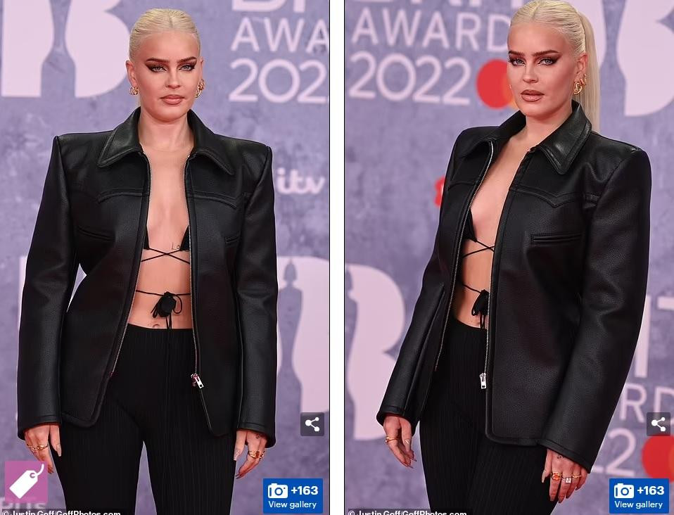 Anne-Marie phanh áo lộ nội y bé xíu.