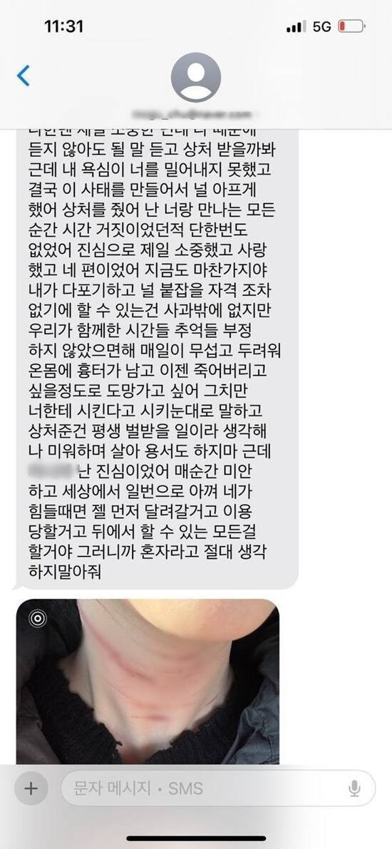 Tin nhắn giữa Kim Sae Ron và anh K, kèm theo hình ảnh được cho là bằng chứng bạo hành. Ảnh: The Fact. Tin nhắn giữa Kim Sae Ron và anh K, kèm theo hình ảnh được cho là bằng chứng bạo hành. Ảnh: The Fact.