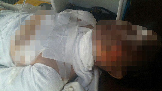 Bị thiêu sống sau khi làm đơn tố cáo bị hiếp dâm ảnh 2