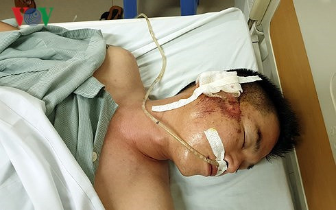 Xác định danh tính tài xế bắn súng, chèn xe qua người lái taxi ảnh 3