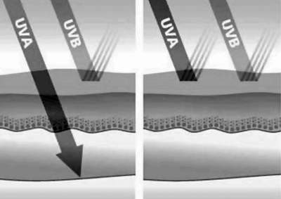 Tia UVA và UVB là tác nhân chủ yếu trong việc gây tổn thương da