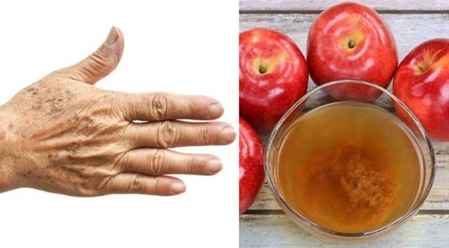 Tẩy nhanh đốm đồi mồi chỉ với loại củ này ảnh 1