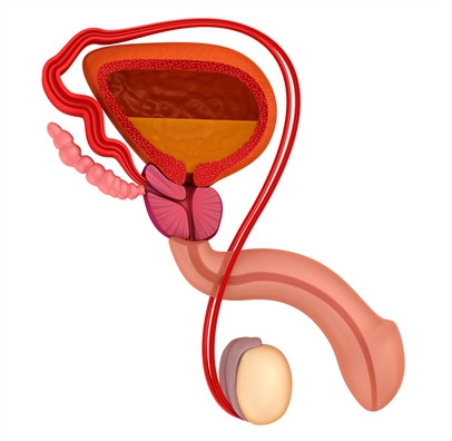 Đàn ông nóng nảy, cộc cằn, cáu gắt, khó đi tiểu… mắc bệnh gì? ảnh 1