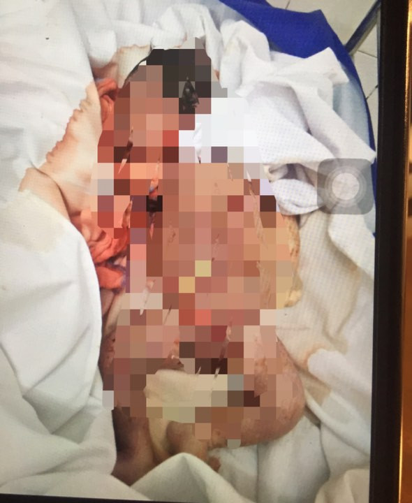 Bé sơ sinh tử vong với vết đứt ở cổ sau ca đẻ thường ảnh 3