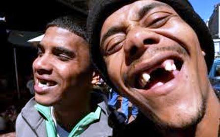 Nhổ răng có thể dẫn đến nhiều hệ lụy nhưng giới trẻ vẫn thích làm đẹp theo kiểu lạ này. Nhổ răng có thể dẫn đến nhiều hệ lụy nhưng giới trẻ vẫn thích làm đẹp theo kiểu lạ này