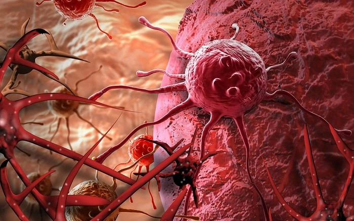 Tế bào ung thư được hình thành từ một tế bào khỏe mạnh nhưng mang gien bị đột biến Tế bào ung thư được hình thành từ một tế bào khỏe mạnh nhưng mang gien bị đột biến