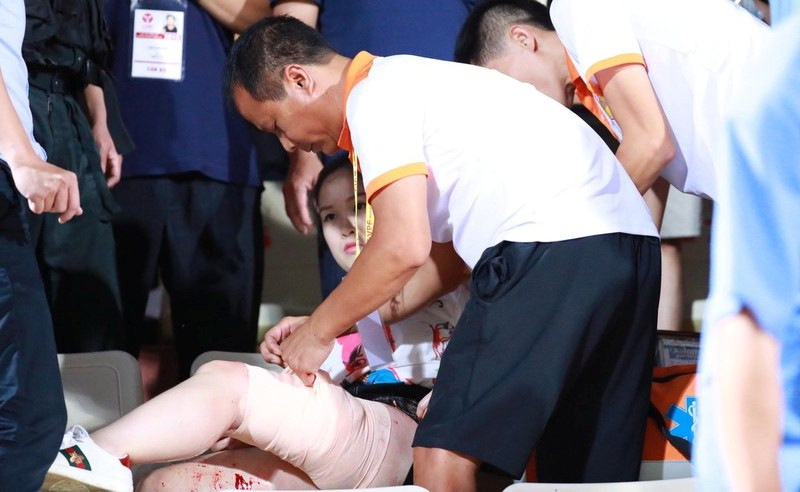 Nữ khán giả bị thương vì trúng pháo sáng trận Hà Nội - Nam Định ảnh 2