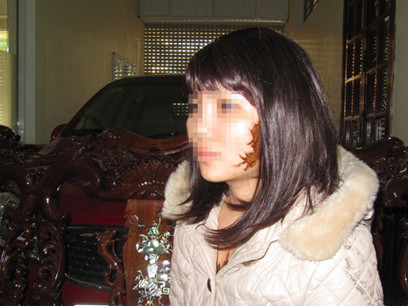 G. đang phải đeo tóc giả để che lấp hình xăm trên khuôn mặt. Ảnh: Khánh Hoan (Thanh Niên)