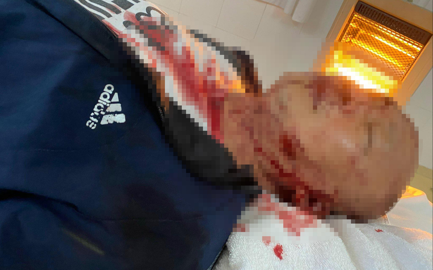 Anh Vũ Đức Hùng nhập viện với vết thương chấn thương sọ não.